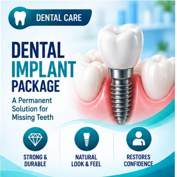 Dental Implant Package