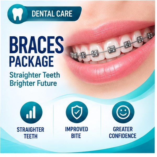 Braces Package